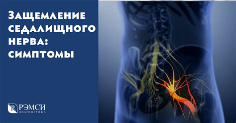 Предотвращение и профилактика защемления нерва в спине