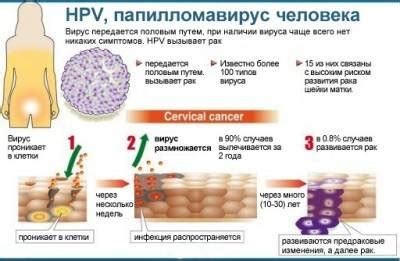 Предупреждение передачи ВПЧ