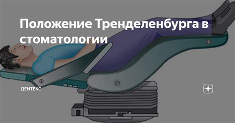 Преимущества положения тренделенбурга при рентгеновском исследовании