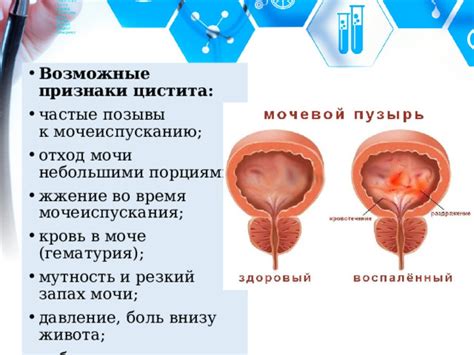 Признаки и причины затруднения мочеиспускания