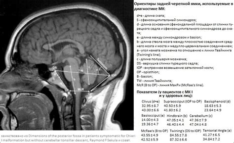 Признаки низкого расположения миндалин мозжечка: