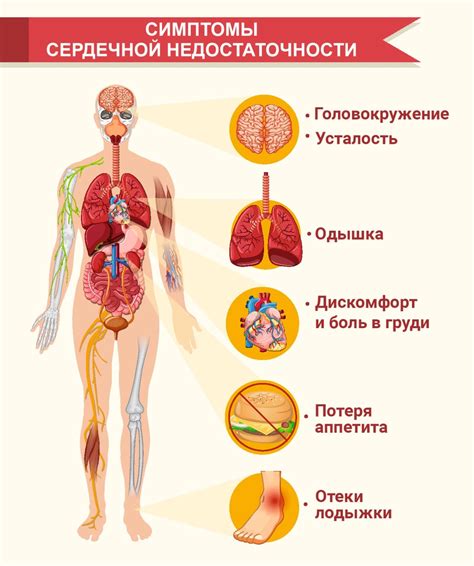 Признаки сосудистой недостаточности