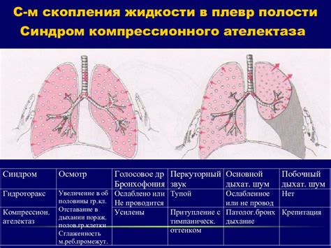 Применяйте методы компрессионного дыхания