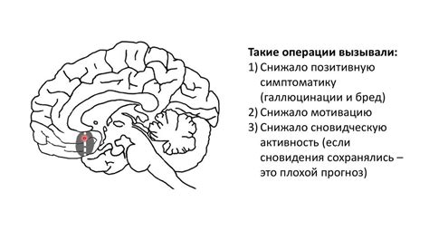 Принципы и факторы толкования сновидений о душении и наваливании