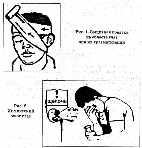 Принципы оказания первой помощи при черепно-мозговой травме