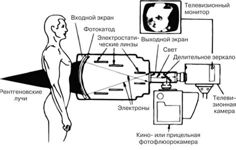 Принцип работы рентгена