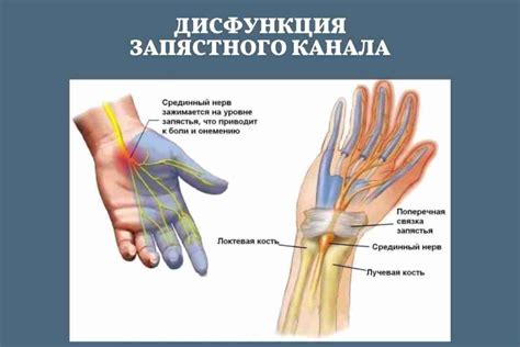 Причины, симптомы и лечение защемления нерва в ноге