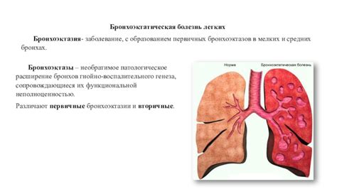 Причины возникновения бронхоэктазов в легких