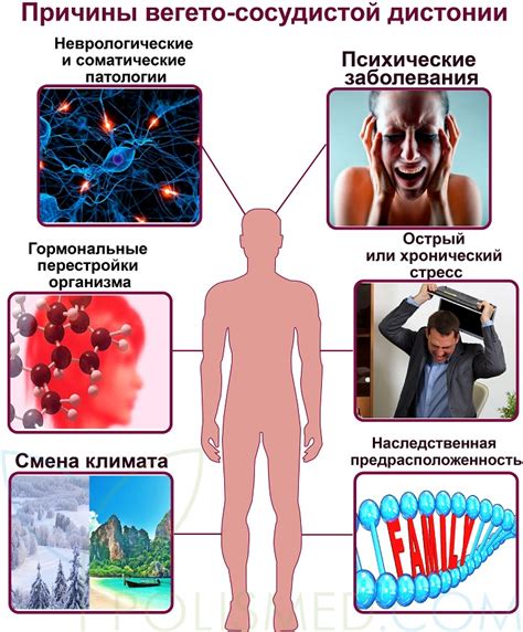 Причины возникновения вегето-сосудистой дистонии