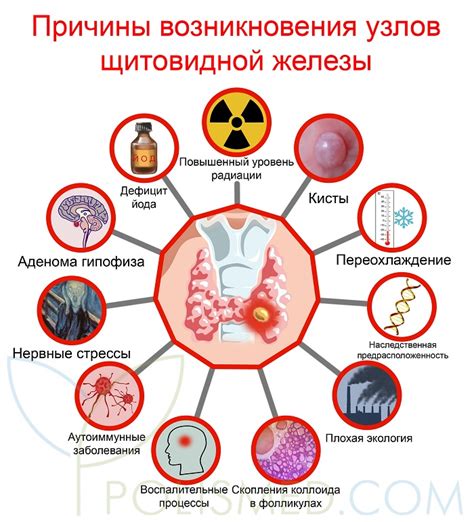 Причины возникновения узлов