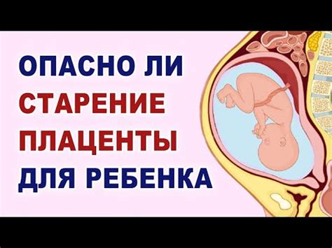 Причины высокого положения плаценты от внутреннего зева