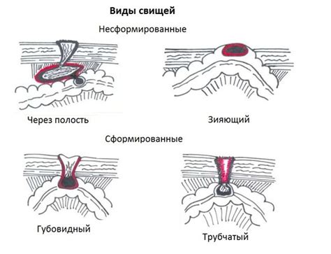 Причины гноения шва после операции на ноге