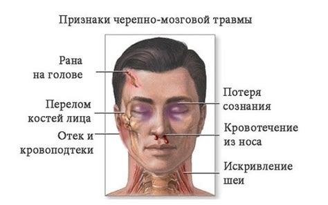 Причины и последствия сильного удара головой при падении