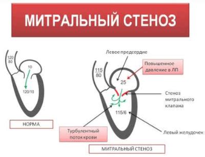 Причины крови из горла