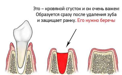 Причины медленного заживления десен после операции и способы ускорить процесс