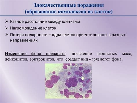 Причины образования атипичных клеток плоского эпителия