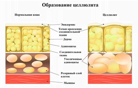 Причины появления височек