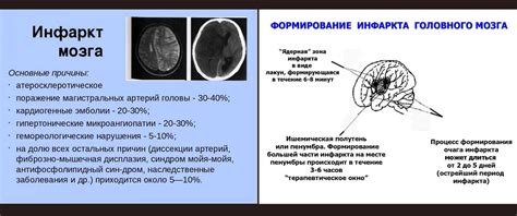 Причины развития дисплазии головного мозга