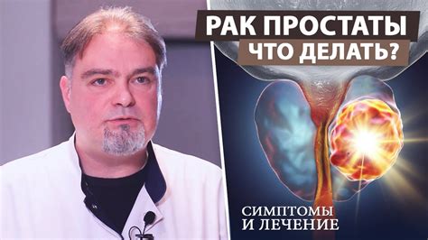 Прогнозы и лечение карциномы предстательной железы