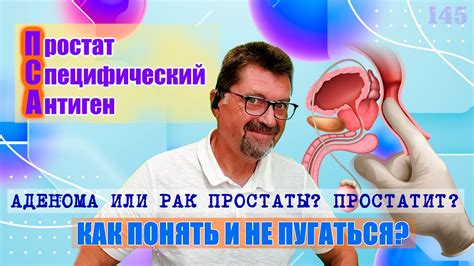 Простатспецифический антиген: роль и значение