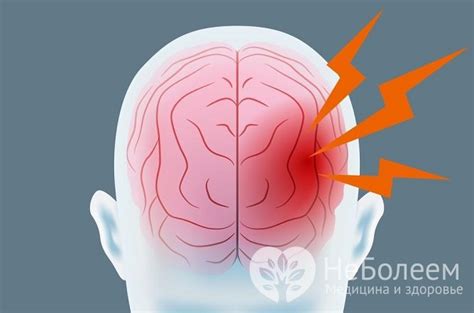 Профилактика кровоизлияния в мозг у новорожденных