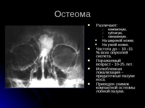 Профилактика появления немоты лобной области