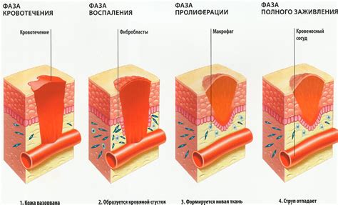 Процесс заживления раны