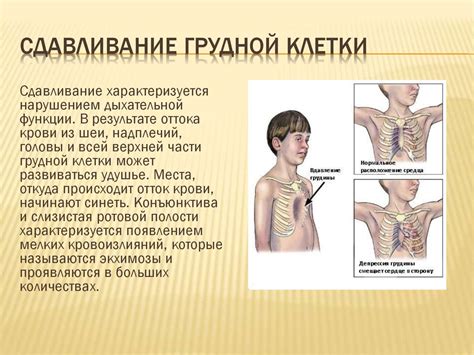 Психологические факторы и сдавливание грудной клетки