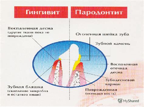 Разбор значения снов, где появляется полость в зубе