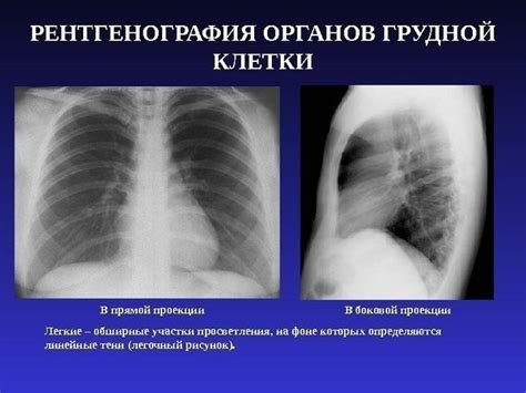 Разница между рентгеном и флюорографией