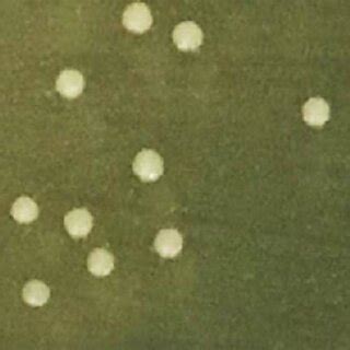 Распространенность Streptococcus oralis