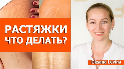 Растяжки на коже: причины и симптомы