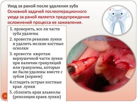 Расшифровка символического значения сна, связанного с кровоточащим выполнении процесса удаления зуба