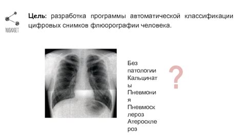 Результаты исследований неброских снимков Флюорографии