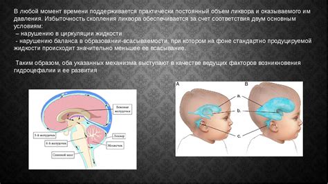 Результаты применения методов лечения дисплазии головного мозга у детей