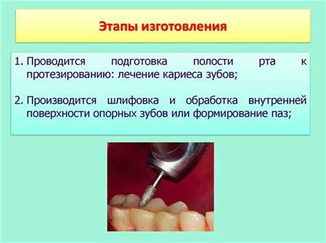 Рекомендации для улучшения состояния полости рта