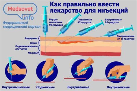 Риски и возможные осложнения внутривенной инъекции