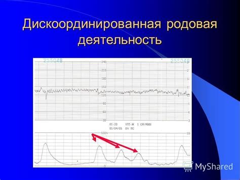 Родовая активность матки