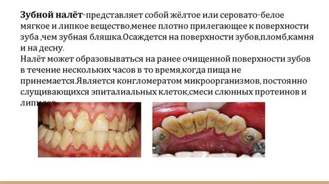 Роль зубного абсцесса в возникновении опухоли на лице