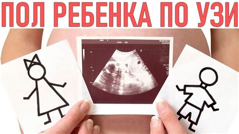 Роль пола родителей в определении пола ребенка