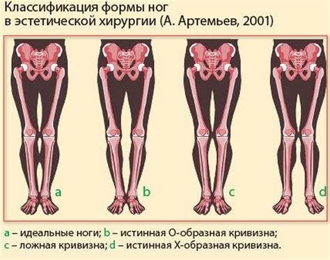 Роль свиных ног в сновидениях у женщин: понимание итога