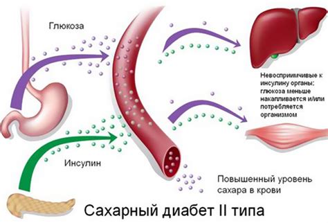 Сахарный диабет или другие медицинские проблемы