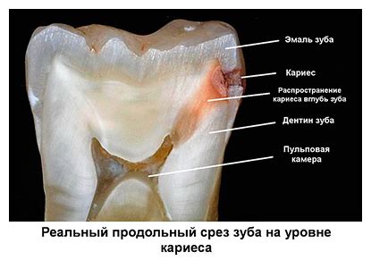 Связь между материнством и подвижностью зубов