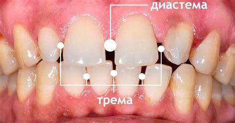 Связь между состоянием зубов во сне и эмоциональным настроем