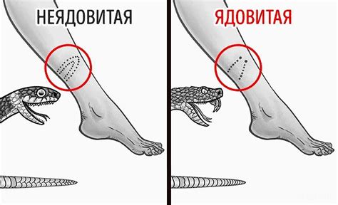 Символика и загадочное значение сна - укус змеи в спину мужчине