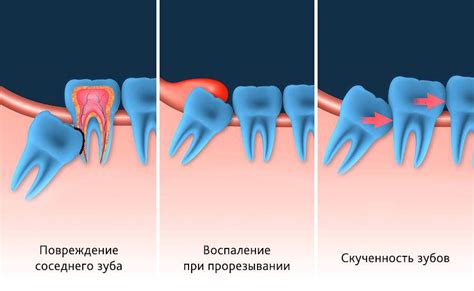 Символический смысл видения о дефекте зуба