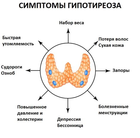 Симптомы гипотиреоза