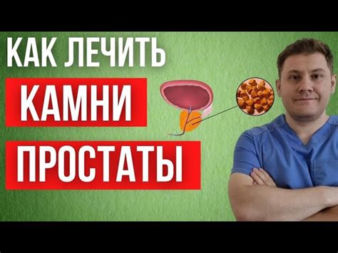 Симптомы единичных кальцинатов в предстательной железе