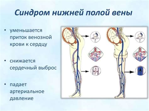 Симптомы и последствия нарушений вены