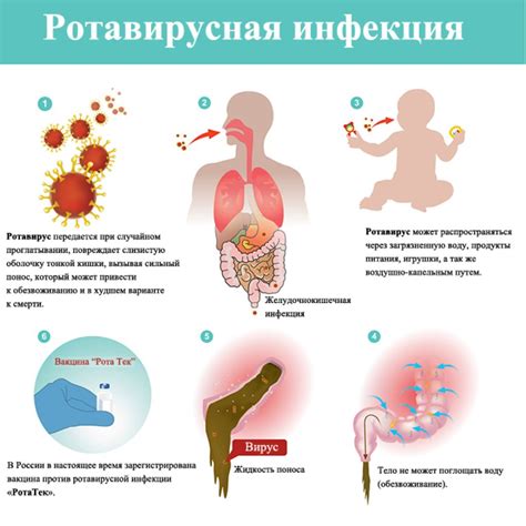 Симптомы и признаки инфекции эболой